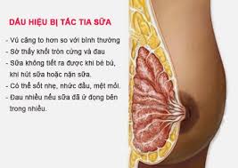 Bài thuốc dân gian chữa tắc sữa (áp xe tuyến vú)
