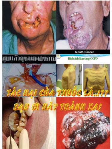 Những thay đổi của cơ thể sau bỏ thuốc